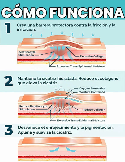 Cinta de silicona médica CicaFlex "Cada cicatriz no tiene que quedarse para siempre.