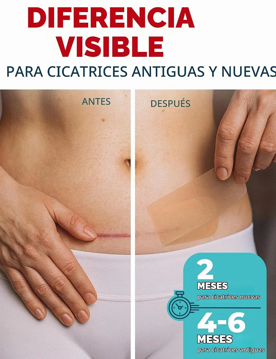 Cinta de silicona médica CicaFlex "Cada cicatriz no tiene que quedarse para siempre.
