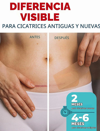 Cinta de silicona médica CicaFlex "Cada cicatriz no tiene que quedarse para siempre.