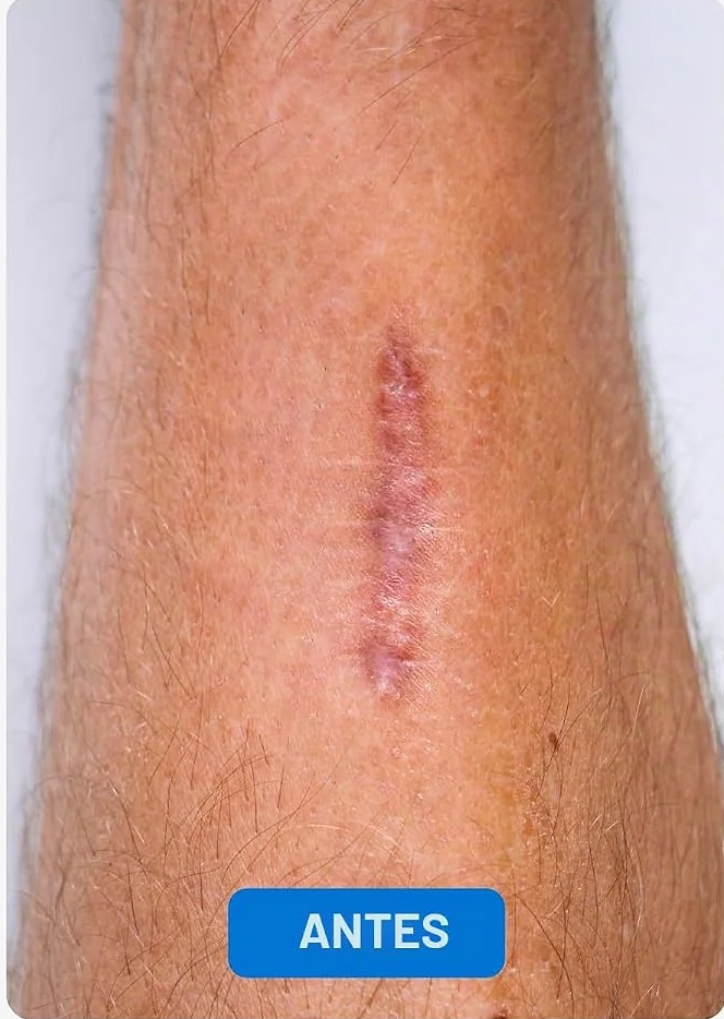 Con CicaFlex