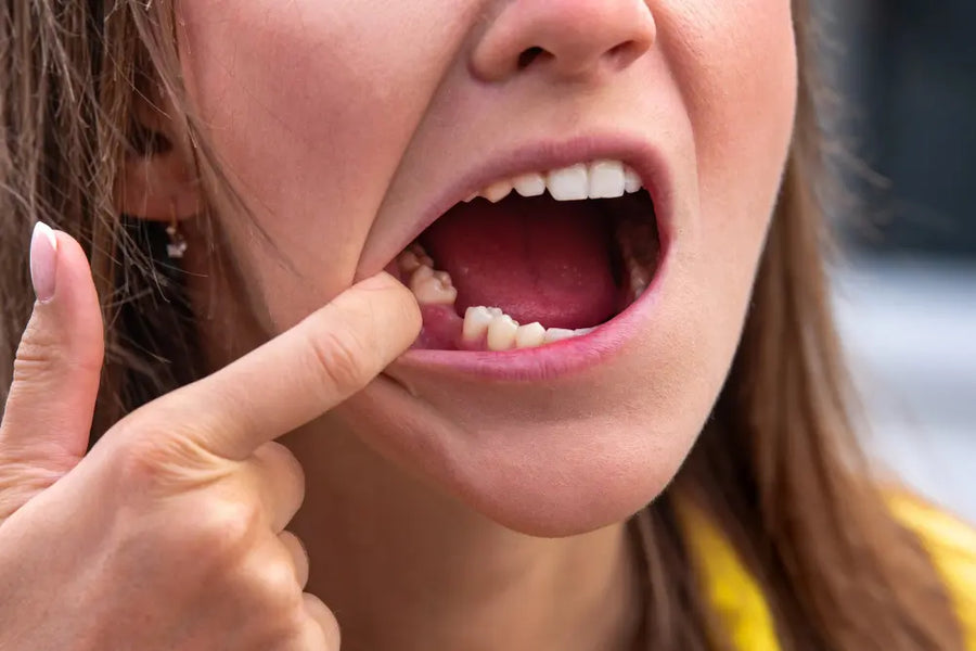 SIN CAVITY
